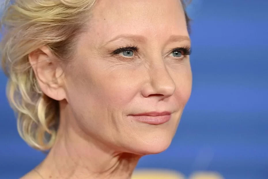 Does Anne Heche have children?/Billyvibes